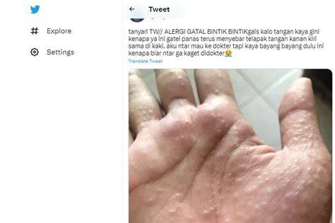 FOTO MEMEK MEREKAH bikin feed ramai Lihat tonjolan kecil — banyak yang nonton streaming dong spesial image 4