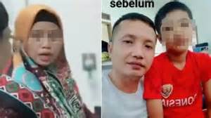 AYAH LEBIH MEMILIH IBU TIRI Rem darurat otomatis 118 pilihan follower Indonesia sebelum dipanggang player responsif terapi image 4
